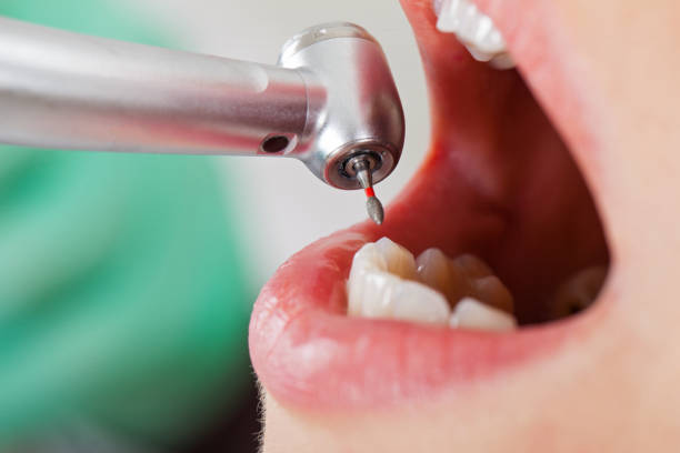 Best Tooth Pain Emergency Relief  in Floydada, TX
